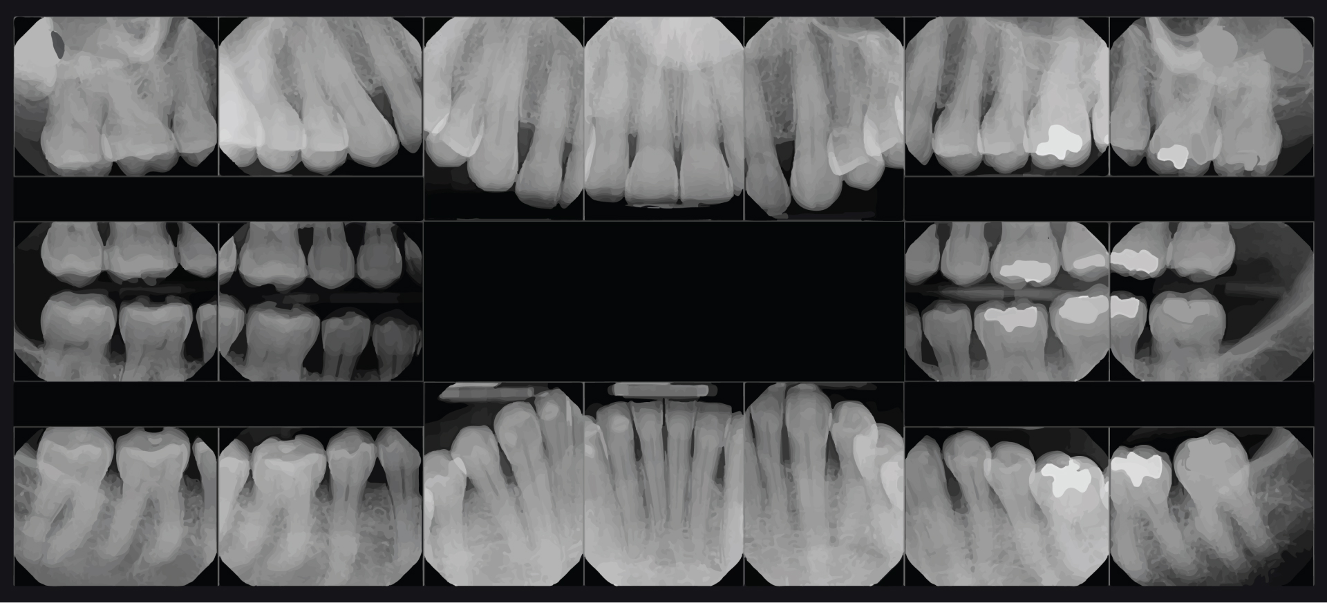 Digital XRays Holistic Dentist in Chicago, IL